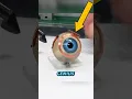 Download Lagu This eye can help blind people see everything ‼️🤯😱. How to stop blindness in the world