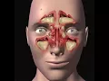 Channel