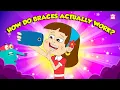 How Do Braces Work How Teeth Aligners Work Orthodontic Treatment The Dr Binocs Show