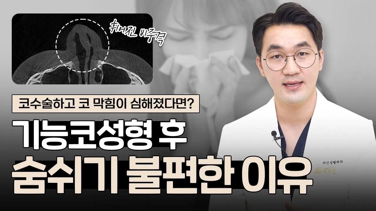 기능코수술 후 코 막힘, 코성형 후 갑자기 숨 쉬기 불편해졌다면?👃 | 비중격만곡증, 안장코, 휘어짐 주의!🚫