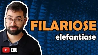 Filariose (Elefantíase) - Aula 16 - Módulo VI: Zoologia | Prof. Guilherme