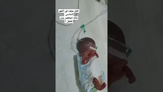 هذا الطفل مولود في الشهر الخامس   برئيكم ما هو سبب الولاده في هكذا مده حمل دندنها