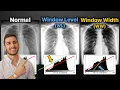 Window Width WW and Window Level WL Explained ImageJ Demo Everything You Need To Know