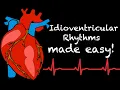 EMS Cardiology Tachy Tuesday Idioventricular Rhythms in EMS