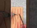 How to suture