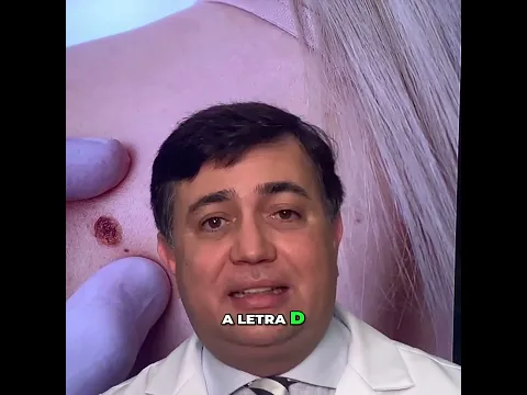 Regra ABCDE: Identifique Sinais de Melanoma #shorts