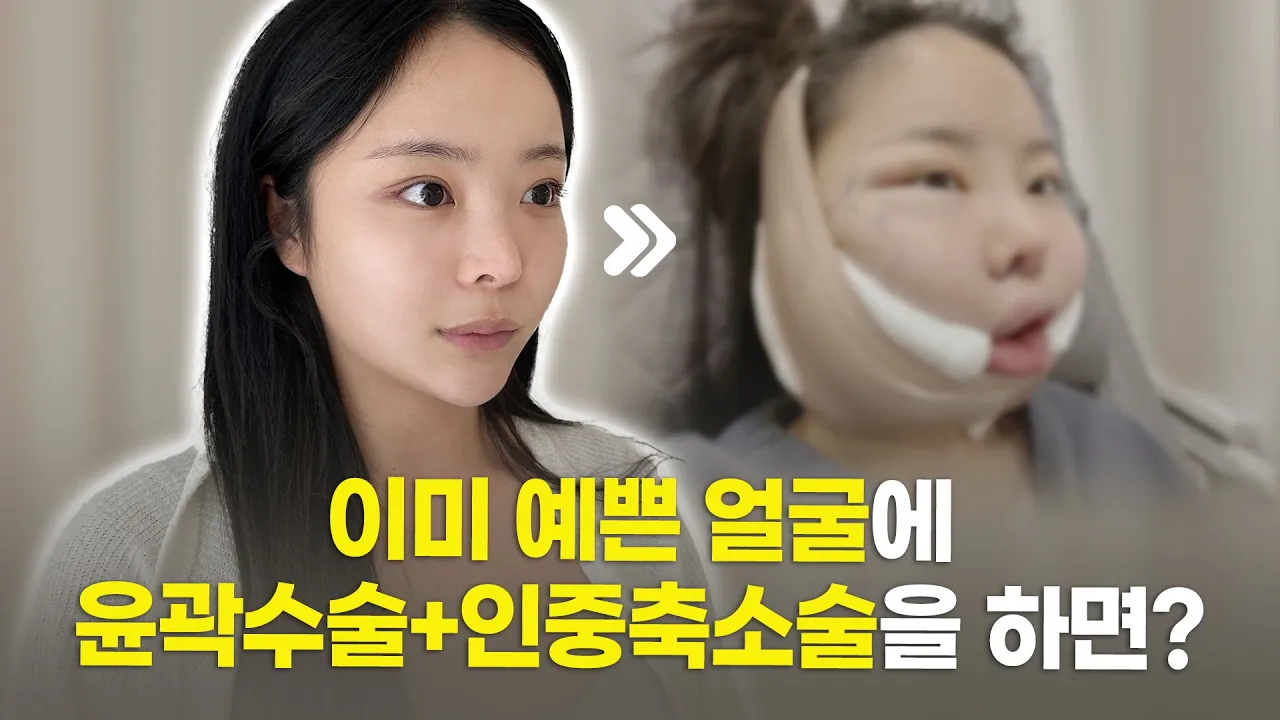 꼬부기 닮은꼴 그녀, 윤곽 인중축소 수술당일 공개!💖
