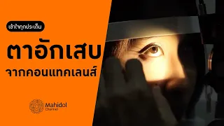 ทำไมการใส่คอนแทคเลนส์รายเดือนถึงมีความเสี่ยงต่อการติดเชื้อสูงกว่าชนิดอื่น