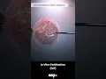 Download Lagu How Does IVF Work? ↪ 3D Medical Animation #Shorts #IVF #Fertilization #Fertility #Pregnancy