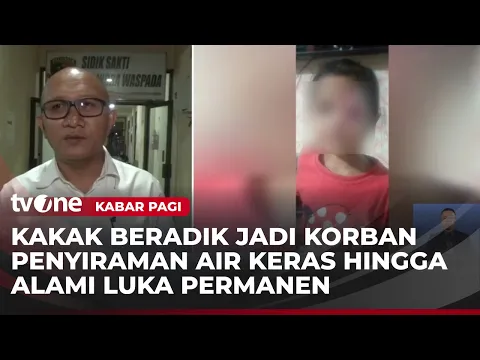 Kakak Beradik Jadi Korban Penyiraman Air Keras di Sumedang