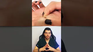 التهاب الجلد  جلدية تجميل ليزر جلدية  قيح  احمرار  التهاب  التهاب الجلد  د مصعب حسوا  ثقف نفسك طبيا دندنها