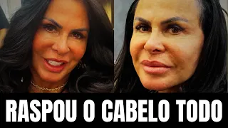 Gretchen exibe a careca no dia da cirurgia capilar