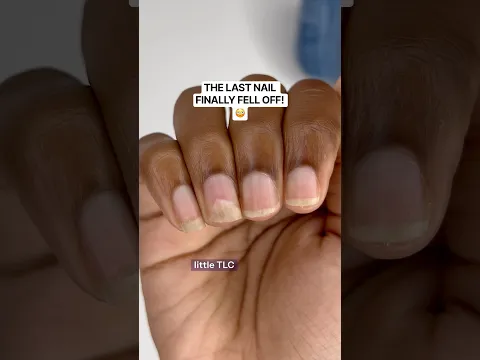 The Last press-on nail Finally fell off! π³ #pressonnails