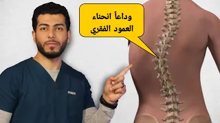 كيفيه التخلص من الجنف او انحناء الظهر الجانبى ٤تمارين لعلاج انحناء العمود الفقري 