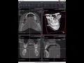 How to upload your CBCT DICOM files and how to use the Medical Viewer in SmileFy