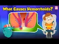 Download Lagu What are Piles? | What Causes Hemorrhoids? | Hemorrhoids: Symptoms and Prevention | Dr. Binocs Show