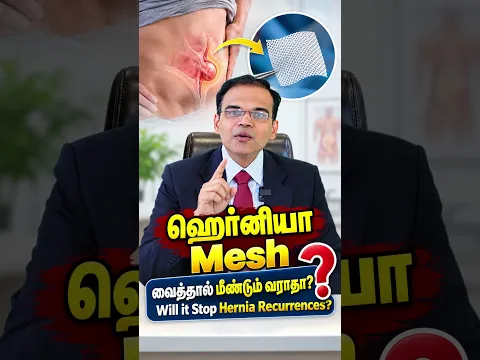 Hernia Mesh வைத்தால் மீண்டும் ஹெர்னியா வராதா? 🤔 | Will Mesh Prevent Hernia Recurrence?
