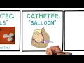 Induction of labor