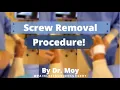 SCREW REMOVAL PROCEDURE quick easy painless