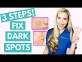 Fix Your Dark Spots in 3 Steps Hyperpigmentation Melasma Skincare Made Simple
