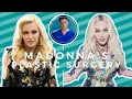 Madonna s Recent Plastic Surgery Why Cher Looks Good