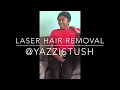 Why I love getting laser hair removal for dark skin
