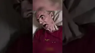 مرض مستر بين 