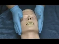 Spinal Injury - Jaw Thrust