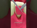 Het verhelpen van terugtrekkend tandvlees #shorts #tandverzorging - Creativelearning3d
