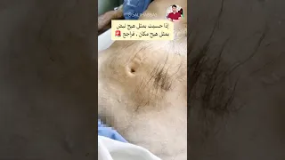 هذه الكتله النابضه بالبطن حوالين السرة هي علامه مهمه 
