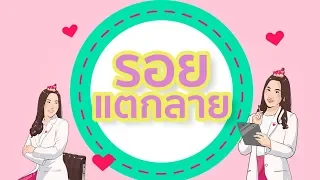 รอยแตกราย หรือ สเตรตช์ มาร์ก เกิดจากสาเหตุอะไร และมักพบในกลุ่มคนใดบ้าง