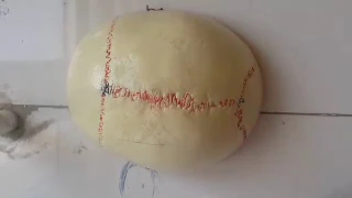                     دندنها