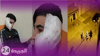                                                                                                      دندنها