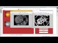 Retinal Disease Screening through Local Binary Patterns matlab projects