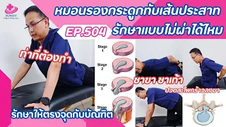 การบริหารเพื่อลดอาการปวดจากหมอนรองกระดูกทับเส้นทำอย่างไร