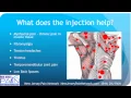 Overview of Trigger Point Injections Explained by a NJ Pain Clinic