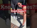Download Lagu How To Fix Your Knock Knees From Home… Grab a Pillow! #knockknees #kneepain #walking