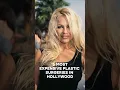 Download Lagu 5 most expensive plastic surgeries in Hollywood