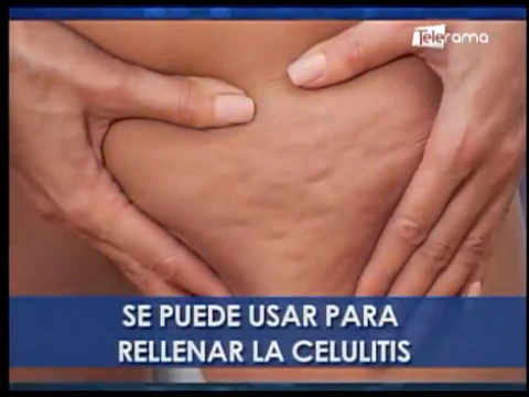 Mitos del ácido hialurónico