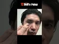 9th Point of Bell s Palsy Massage for Eye Movement