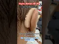 Download Lagu Signia Motion SP 1PX BTE hearing aids for severe hearing loss #hearingaids #viral #shortsfeed #viral
