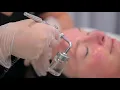 SKIN TREATMENT WITH OXYGEN by Beauty on Rose Essendon Melbourne