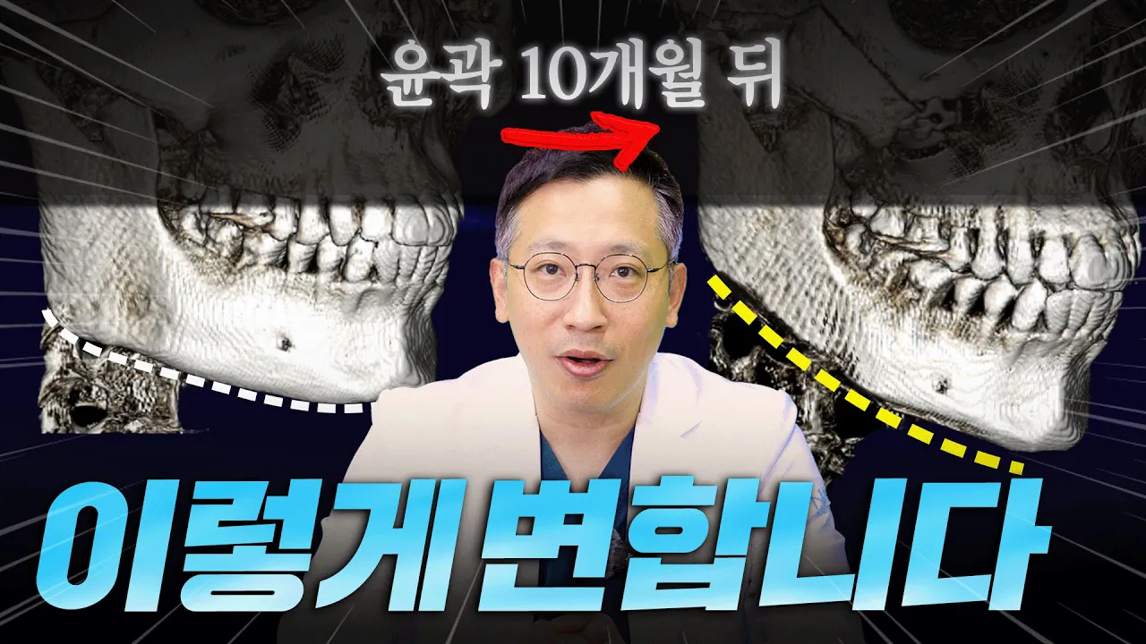 윤곽하면 어떻게 달라지냐고? 직접 보세요!