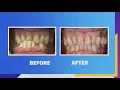 From hopelessness to happiness Dr White helps his patient smile again