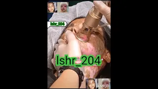 الاميرة مريم تشوهت بتيزاب شكلها بعد العمليه دعاكم بشفاء 