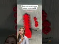Best Braces Colors-Red Before and After