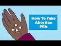 Download Lagu How to Take Abortion Pills | Planned Parenthood Video