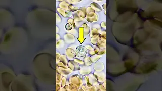 Infection Under The Microscope 