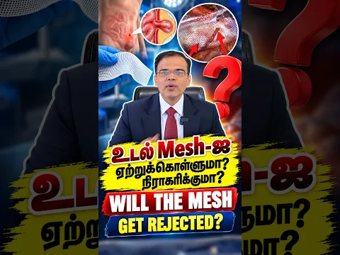உடல் Mesh-ஐ ஏற்றுக்கொள்ளுமா? நிராகரிக்குமா? 😨 | Mesh Rejection & Failure Explained in Tamil