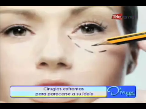 Cirugías extremas para parecerse a su ídolo